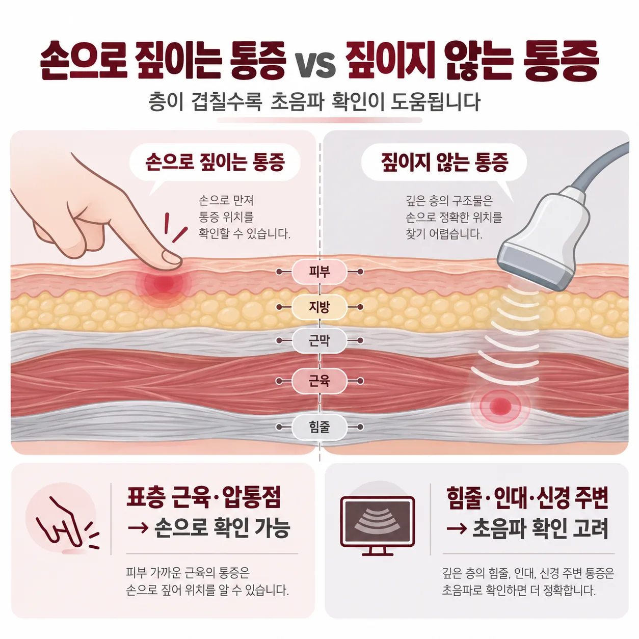 피부에서 힘줄까지 층이 겹친 단면과 촉진으로 확인되는 범위를 비교한 개념도