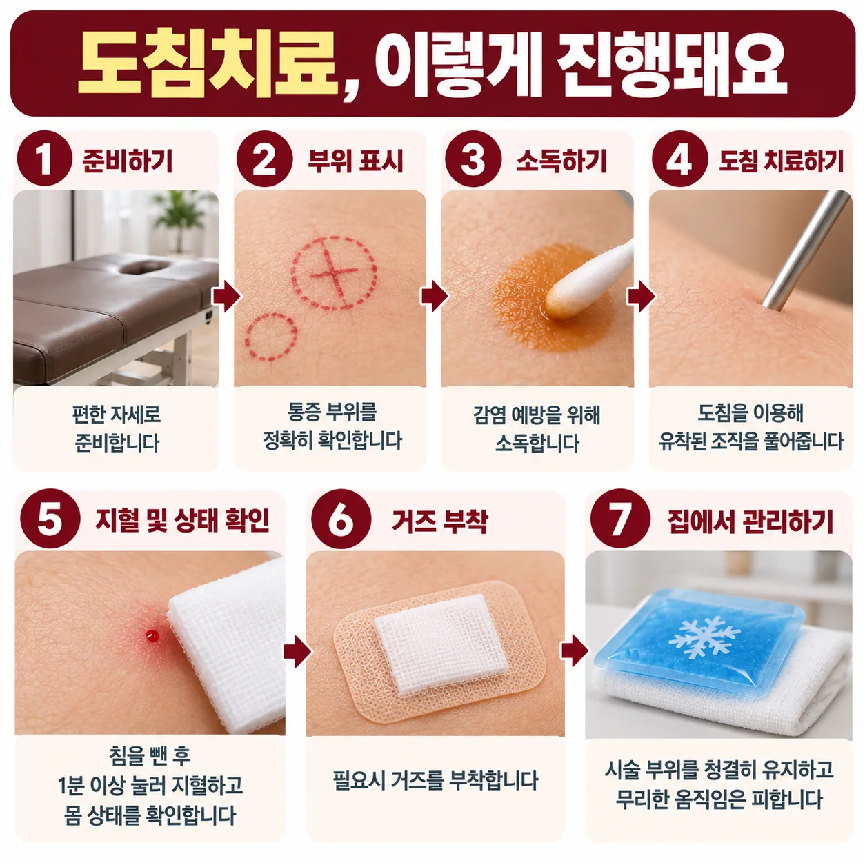 도침치료 시술 순서를 단계별로 정리한 순서도