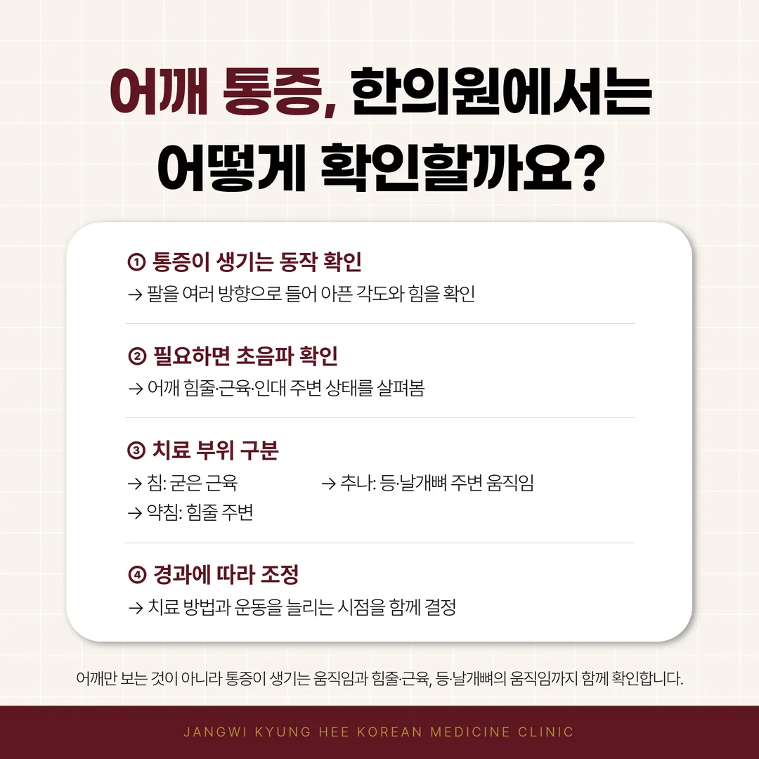 어깨 통증에서 침 약침 추나가 각각 다루는 어깨 주변 부위를 나눈 개념도