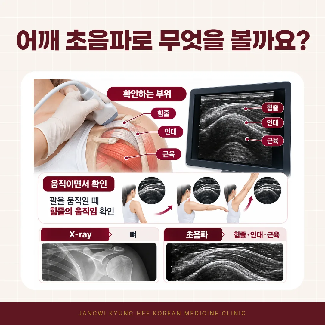 교통사고 어깨 통증 초음파로 보는 어깨 힘줄 인대 근육 안내도