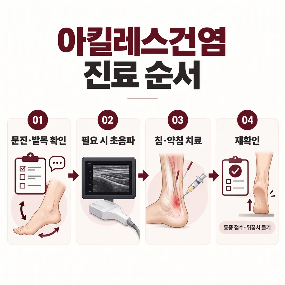 아킬레스건염 진료 순서 문진 초음파 확인 치료 재확인 흐름도