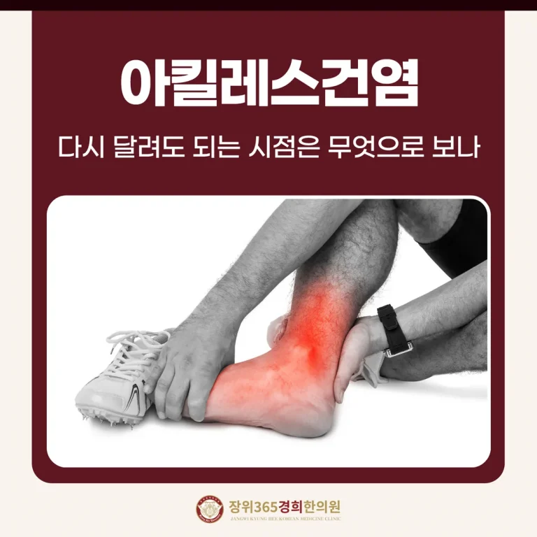 아킬레스건염, 다시 달려도 되는 시점은 무엇으로 보나