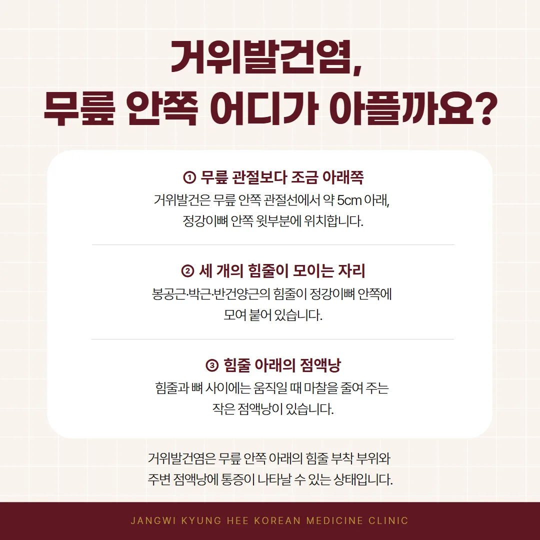 무릎 안쪽 아래 정강이뼈에 세 힘줄이 모여 붙는 거위발 위치 개념도
