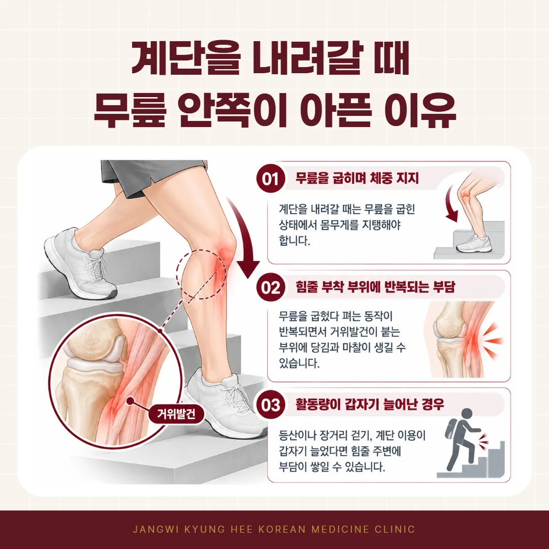 계단을 오르내릴 때 무릎 안쪽 아래 힘줄이 붙는 자리에 부담이 실리는 개념도