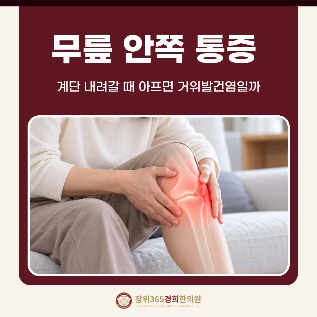 무릎 안쪽 통증, 계단 내려갈 때 아프면 거위발건염일까