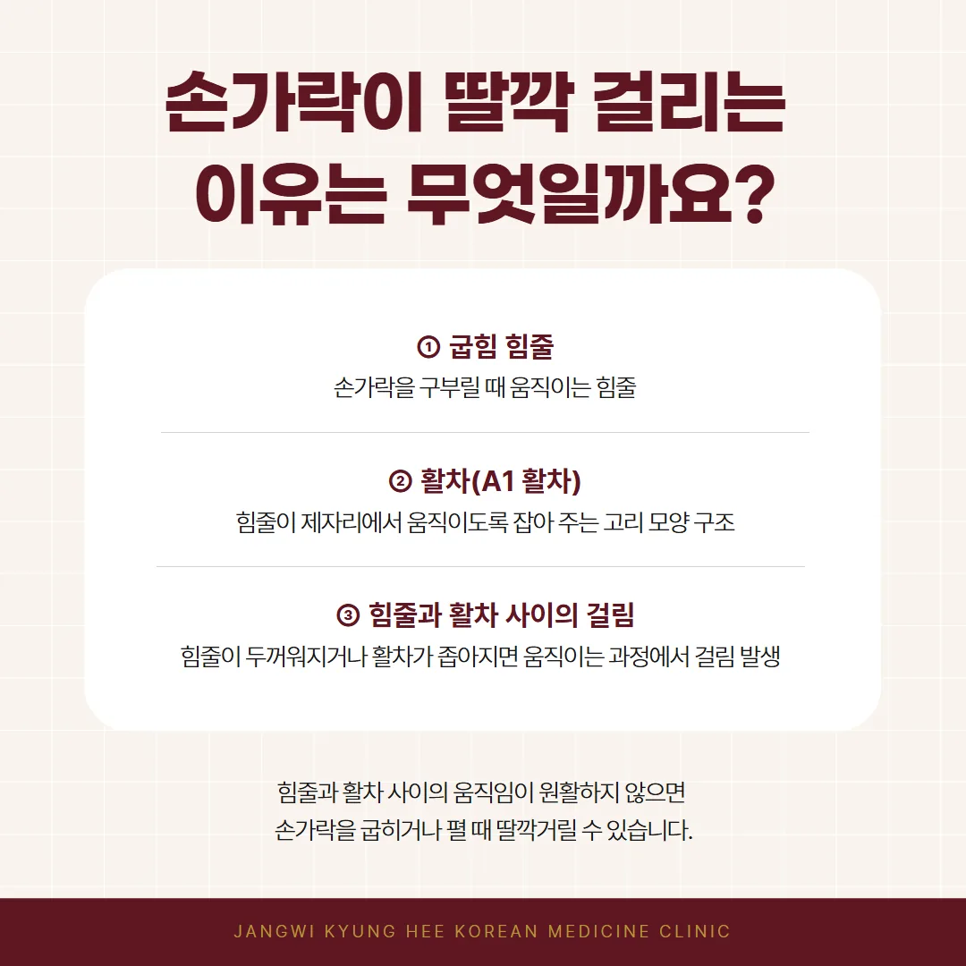 방아쇠수지에서 손가락 굽힘 힘줄이 활차 통로에 걸리는 원리 개념도