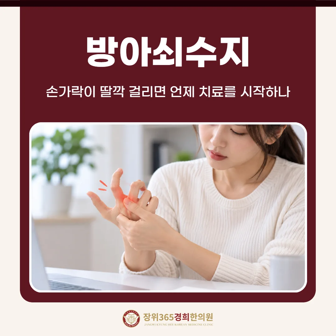 방아쇠수지, 손가락이 딸깍 걸리면 언제 치료를 시작하나